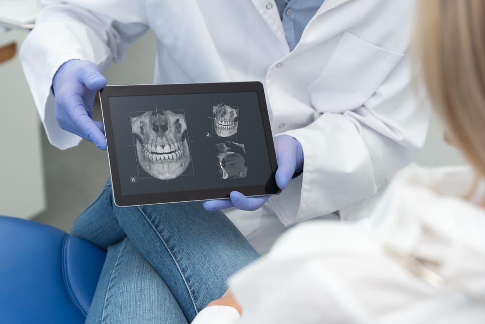 Are Dental X Rays safe? Benefits vs Risks