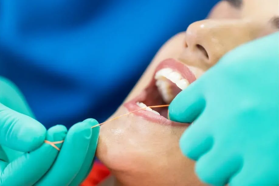 Why is Flossing Important?